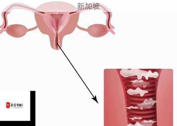 阴道干涩缺乏湿润？有效改善干涩问题的方法